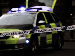 Alton assault victim suffered broken cheekbone and eye socket