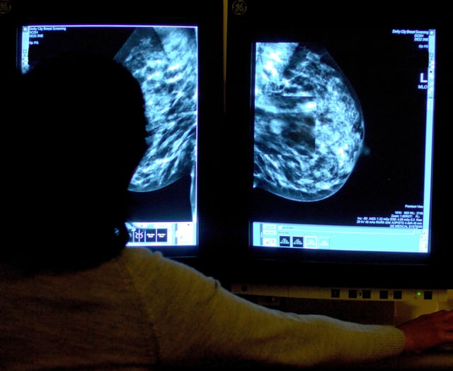 Hundreds of 'missing' cancer diagnoses in Surrey Heartlands in 2020 – as fewer found at early stage