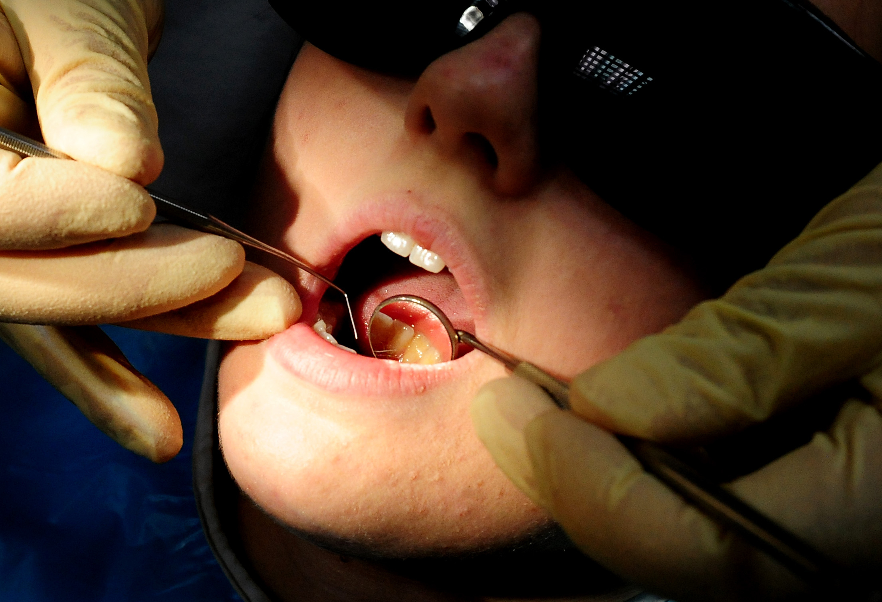 Dozens of hospital admissions in Woking to remove children's rotten teeth