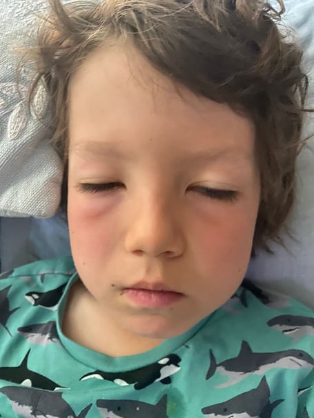 Lawrence after he was gassed by police after being caught in a pro-Palestine protest in Paris. A British family on holiday were tear-gassed by French police when they accidentally got caught in pro-Palestine protests. Mum-of-one Radia Austin, 46, has questioned if Paris is a safe place to host the Olympics in July after son Lawrence, eight, was left with acute eye problems. She says the schoolboy was left screaming in agony after police "blindly" threw tear gas cannisters into the crowd of protestors. Radia, Lawrence, and dad Paul Austin, 45, were returning to their apartment nearby when one of the cannisters landed at the lad's feet. 