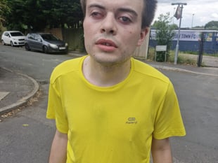 Blind Lee to take on his hardest fundraising challenge yet