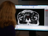 More men diagnosed with prostate cancer in the Surrey heartlands
