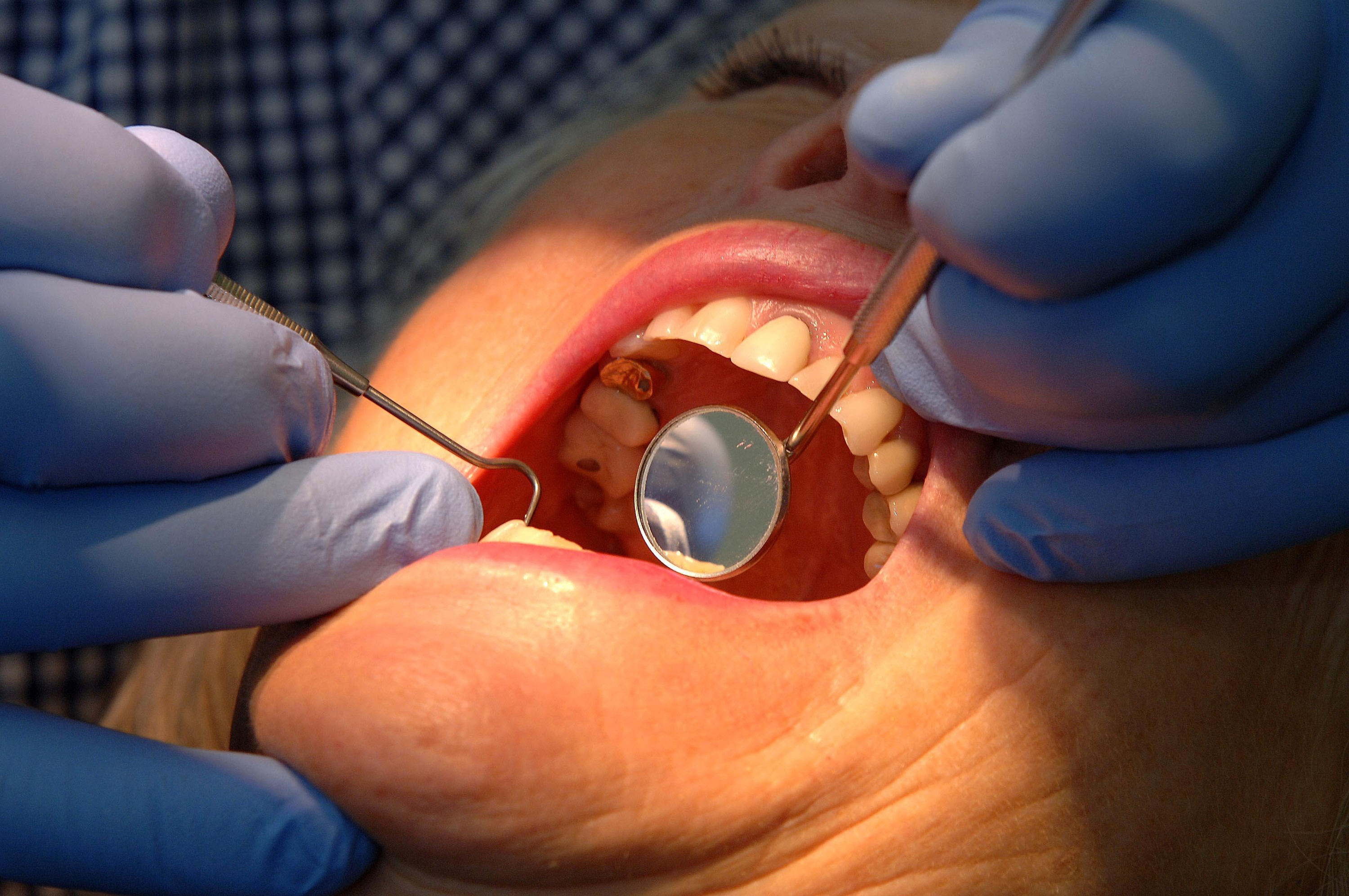  People in the Surrey heartlands more likely to have access to an NHS dentist – as 'postcode lottery' sees thousands miss out