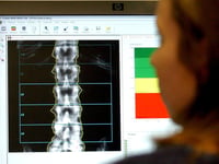 One in seven people in Woking suffer joint, bone and muscle conditions